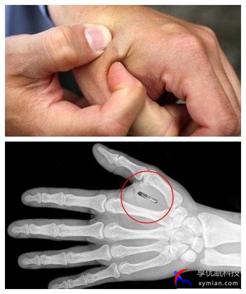 1503202484614099.jpg 311s7b667b.jpg